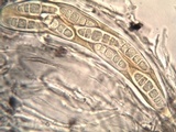 Opegrapha mougeotii image