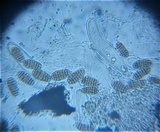 Pleospora herbarum image
