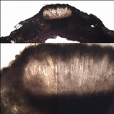 Schismatomma graphidioides image
