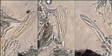 Schismatomma graphidioides image