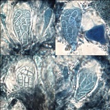 Arthonia meridionalis image