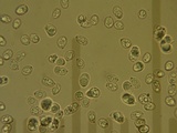 Lichenomphalia umbellifera image
