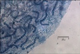 Blennothallia crispa image