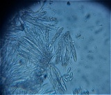 Petractis nodispora image