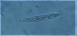 Petractis nodispora image