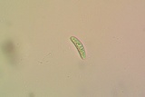 Lecanactis californica image