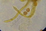 Polycephalomyces tomentosus image