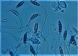 Pestalotia pezizoides image