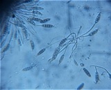 Pestalotia pezizoides image