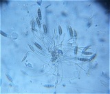 Pestalotia pezizoides image