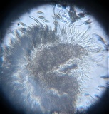 Pestalotia pezizoides image
