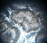 Pestalotia pezizoides image
