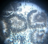 Pestalotia pezizoides image