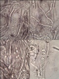 Tephromela atra var. atra image