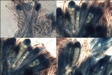 Tephromela atra var. atra image