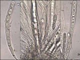 Acrocordia macrospora image