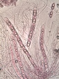 Acrocordia macrospora image