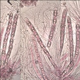 Acrocordia macrospora image