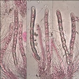 Acrocordia macrospora image