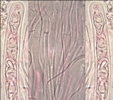 Acrocordia macrospora image