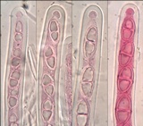 Acrocordia macrospora image