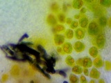 Dimerella pineti image