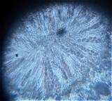 Trapelia coarctata image