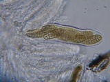 Pleospora herbarum image