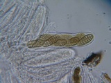 Pleospora herbarum image