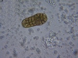 Pleospora herbarum image