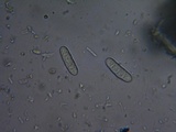 Mellitiosporiella macrospora image