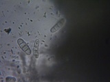 Mellitiosporiella macrospora image