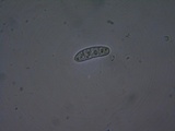 Mellitiosporiella macrospora image