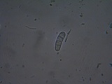 Mellitiosporiella macrospora image