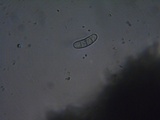 Mellitiosporiella macrospora image