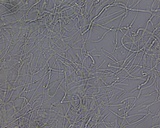 Plectania melastoma image