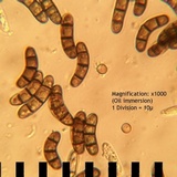 Chaetosphaerella phaeostroma image