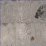 Placynthium subradiatum image