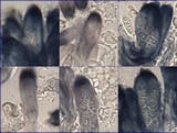 Placynthium subradiatum image