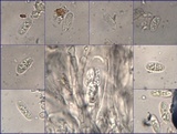 Placynthium subradiatum image