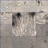 Placynthium subradiatum image