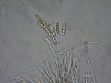 Erikssonopsis ericae image