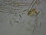 Erikssonopsis ericae image