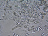 Glomerella cingulata image