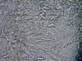 Glomerella cingulata image