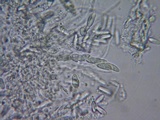 Glomerella cingulata image
