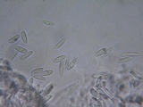 Glomerella cingulata image