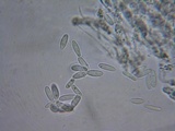 Glomerella cingulata image