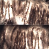 Oedohysterium pulchrum image