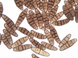 Oedohysterium pulchrum image